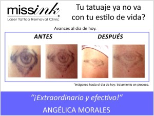 MISS INK CASOS