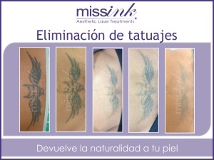 casos reales Missink