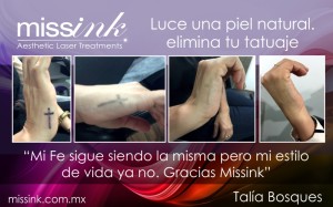 Missink elimina tu tatuajes