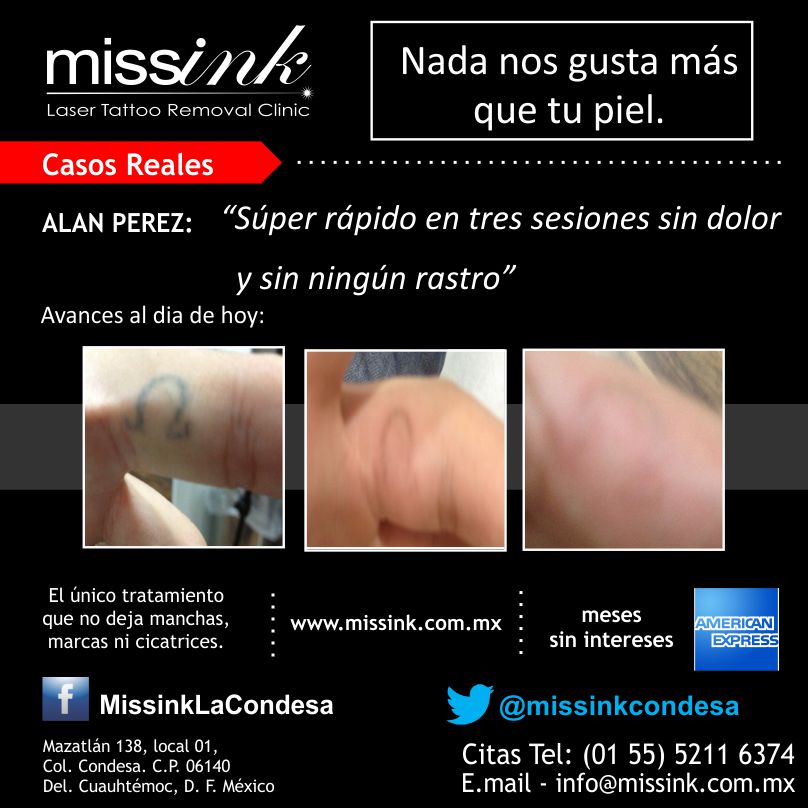 Missink Casos Reales