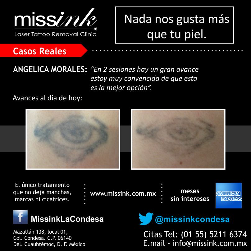 Missink Casos Reales