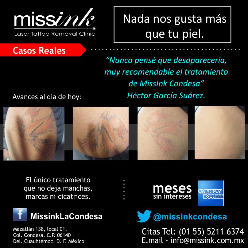 Missink Casos Reales