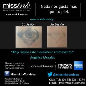 Missink Casos Reales
