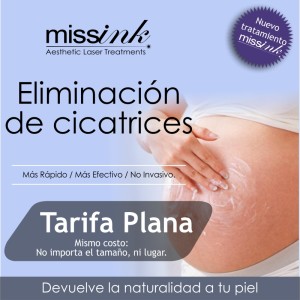 estrias missink