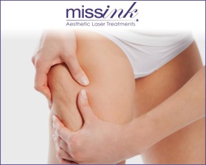missink celulitis