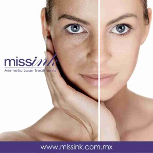 missink piel