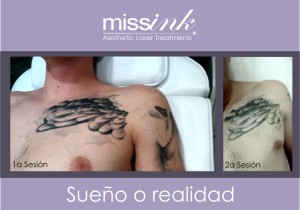 banner blog missink